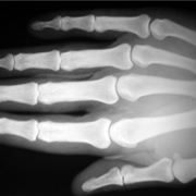 image of x-ray scanning