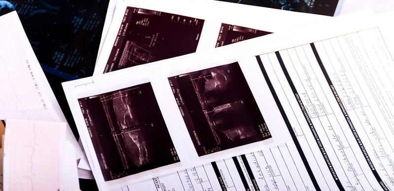 Scanning Medical Charts