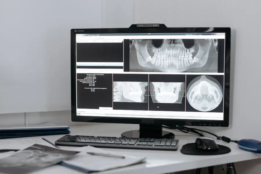 Record Nations will scan your patient's dental records 