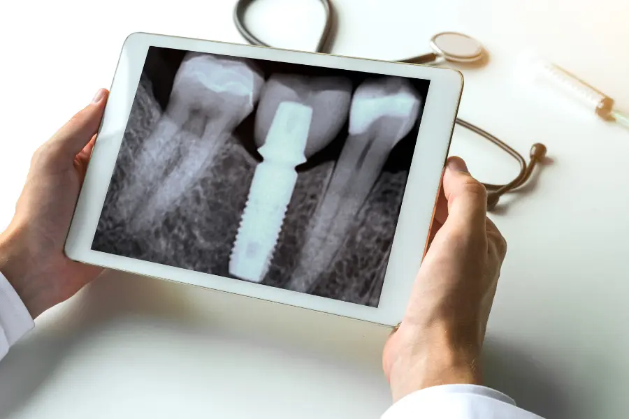 Record Nations will scan your dental x-ray film 