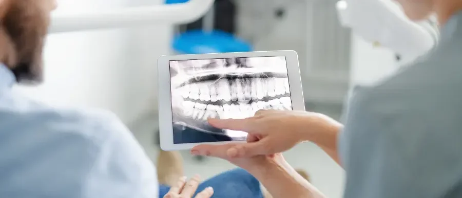 How to Scan Dental X-Ray Film